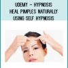 Udemy – Hypnosis – Heal Pimples Naturally Using Self Hypnosis at Tenlibrary.com